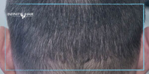 المنطقة المانحة