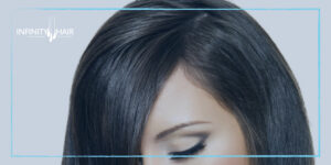 حقن الميزوثيرابي للشعر