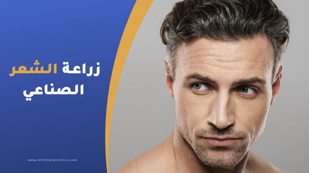 زراعة الشعر الصناعي الايطالي في تركيا