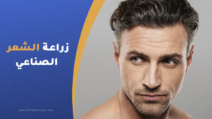 زراعة الشعر الصناعي الايطالي في تركيا