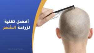 أفضل تقنية لزراعة الشعر