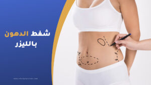 شفط الدهون بالليزر في تركيا