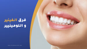 الفرق بين الفينير واللومينير