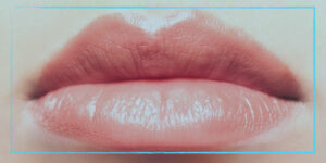 توريد الشفاه بالليزر - تفتيح الشفاه بالليزر