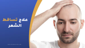 علاج تساقط الشعر في تركيا