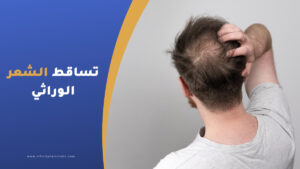 علاج تساقط الشعر للرجال الوراثي