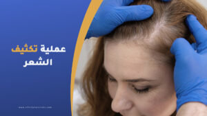 تكثيف الشعر في تركيا