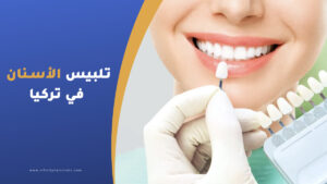 تلبيس الأسنان في تركيا