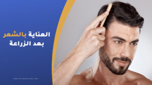 تعليمات العناية بالشعر بعد زراعة الشعر