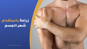 زراعة الشعر باستخدام شعر الجسم - تقنية BHT