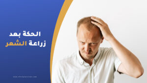 علاج الحكة بعد عملية زراعة الشعر