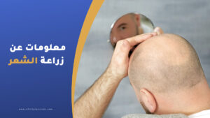 معلومات عن زراعة الشعر