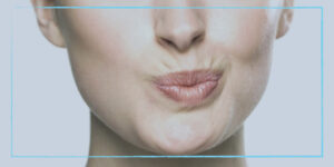 نصائح بعد حقن الفيلر