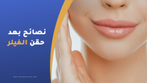 نصائح بعد حقن الفيلر