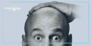 زراعة الشعر في أماكن الجروح و الحروق