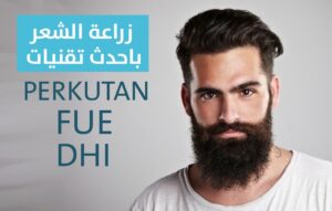 أحدث تقنيات زراعة الشعر لعام 2018