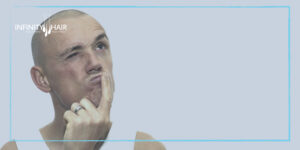 أسباب فشل عملية زراعة الشعر