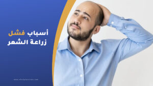 أسباب فشل عملية زراعة الشعر