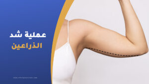 عملية شد الذراعين في تركيا