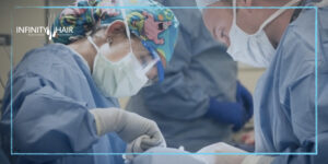 عوامل نجاح عملية زراعة الشعر