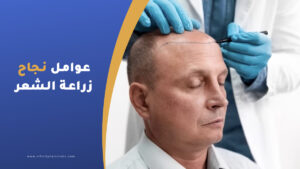 عوامل نجاح عملية زراعة الشعر