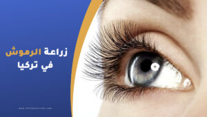 زراعة الرموش في تركيا ؟