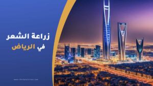 زراعة الشعر في الرياض