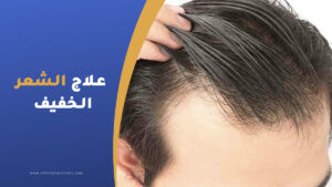 علاج الشعر الخفيف من الأمام.