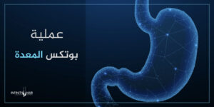 عملية بوتكس المعدة في تركيا