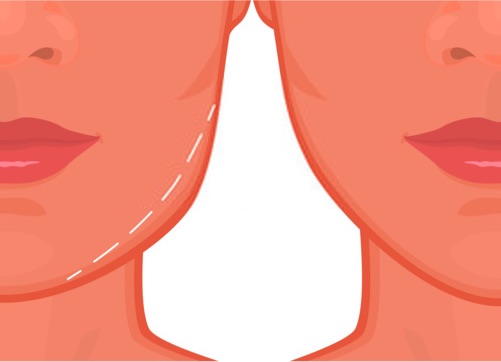 حالات بحاجة إلى تقنية تكساس
