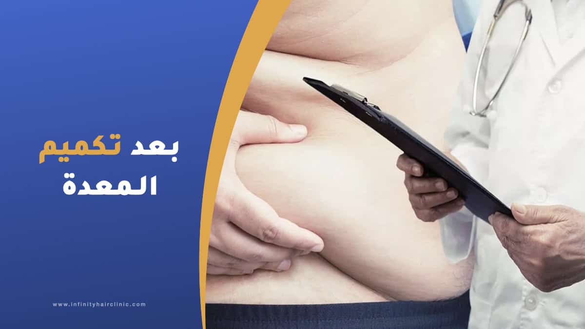 ما بعد عملية تكميم المعدة تعليمات ونصائح بعد التكميم انفينتي كلينك
