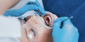 اضرار ومخاطر زراعة الأسنان