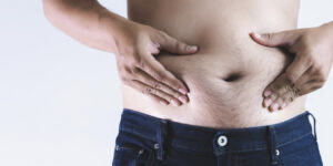 تعليمات ما بعد بالون المعدة