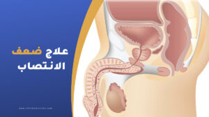 علاج ضعف الانتصاب في تركيا