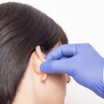 عملية تجميل الأذن في تركيا