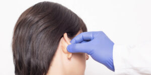 عملية تجميل الأذن في تركيا