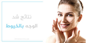 متى تظهر نتائج عملية شد الوجه
