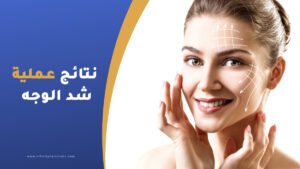 متى تظهر نتائج عملية شد الوجه