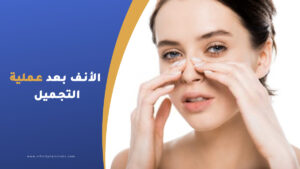 متى يستقر شكل الأنف بعد عملية التجميل