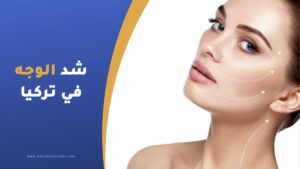 شد الوجه في تركيا