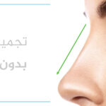 طرق تجميل الأنف بدون جراحة