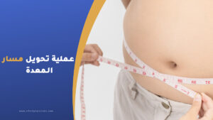 عملية تحويل مسار المعدة