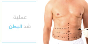 عملية شد البطن في تركيا