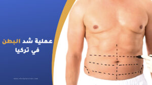 عملية شد البطن في تركيا