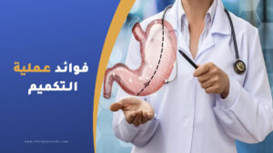 فوائد عملية التكميم
