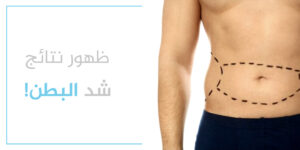 متى تظهر نتائج عملية شد البطن