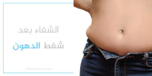 مدة الشفاء بعد عملية شفط الدهون