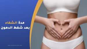 مدة الشفاء بعد عملية شفط الدهون