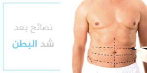 نصائح بعد عملية شد البطن