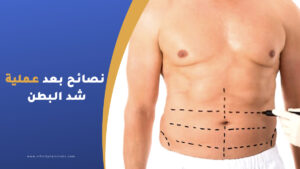 نصائح بعد عملية شد البطن